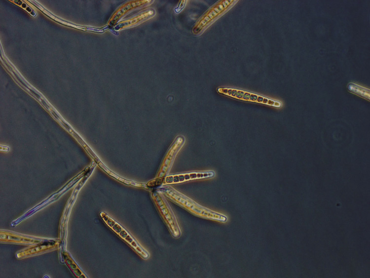images/exserohilum-rostratum-960px.jpg