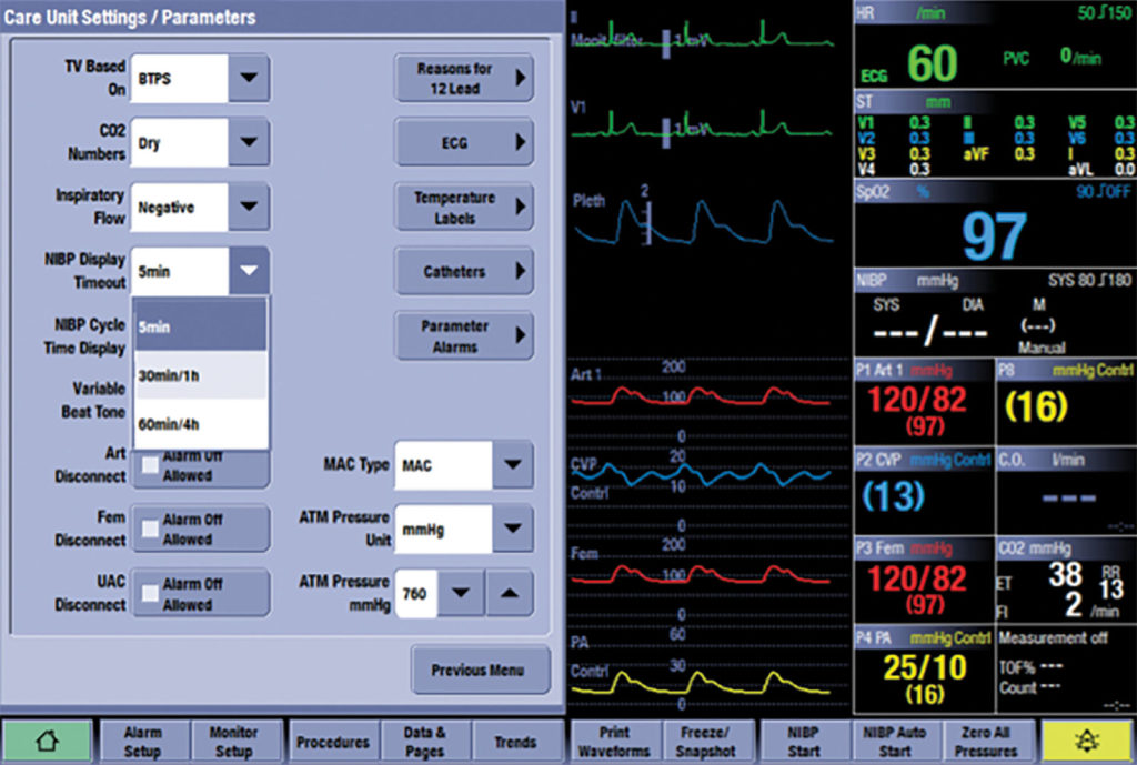 Figure 4: NIBP Display Timeout selection.