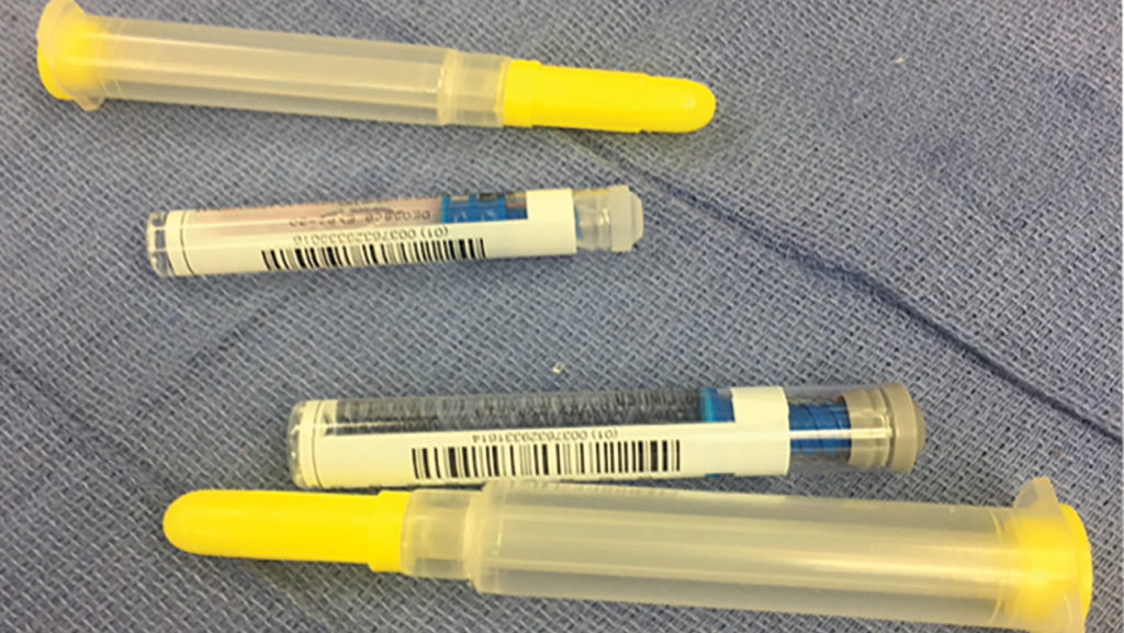 Figura 1B: Describe la etiqueta trasera de las jeringas de lidocaine (lidocaína) al 2 % y de epinephrine (epinefrina) de 0,1 mg/ml. Observe la similitud entre las jeringas.