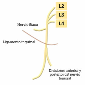 Figura 1: Ilustración del nervio femoral que pasa debajo del ligamento inguinal y la ramificación del nervio ilíaco más proximal al ligamento inguinal.