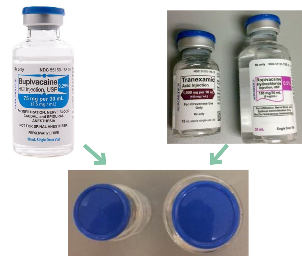 Figure 3 : Des flacons d’acide tranexamique, de ropivacaïne et de bupivacaïne avec le même capuchon de couleur bleue. 