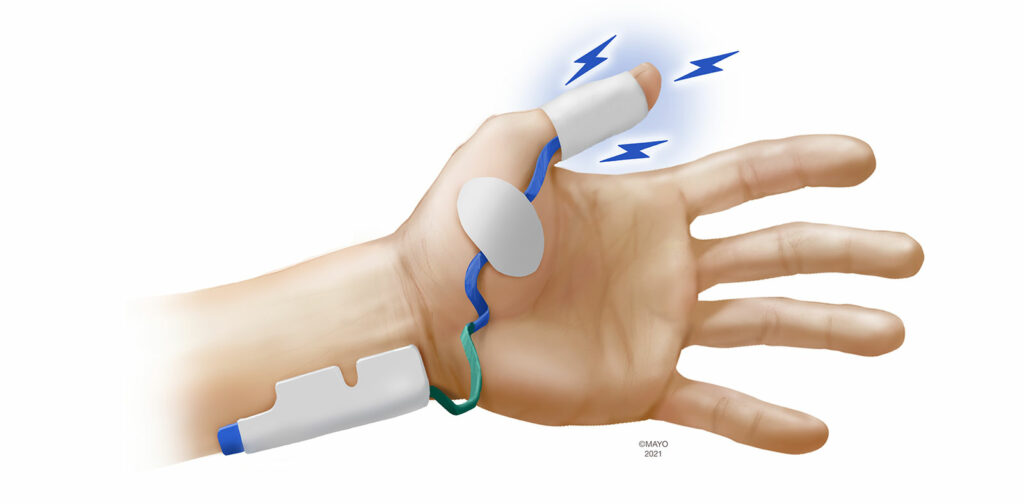 Figure 3: Electromyography<br /> <br /> All figures are original produced by author.