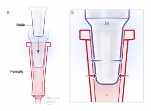 Figura 1: A) Conectores cónicos macho y hembra Luer desacoplados. B) Conectores cónicos Luer acoplados para formar una conexión sin fugas. Las flechas indican las fuerzas de compresión entre las paredes interna y externa del cono. La conexión se fija mediante la combinación de fuerzas de compresión y fricción entre las superficies de contacto. Tenga en cuenta que las conexiones secas suelen ser menos propensas a desconectarse que cuando las superficies de los conos están mojadas.