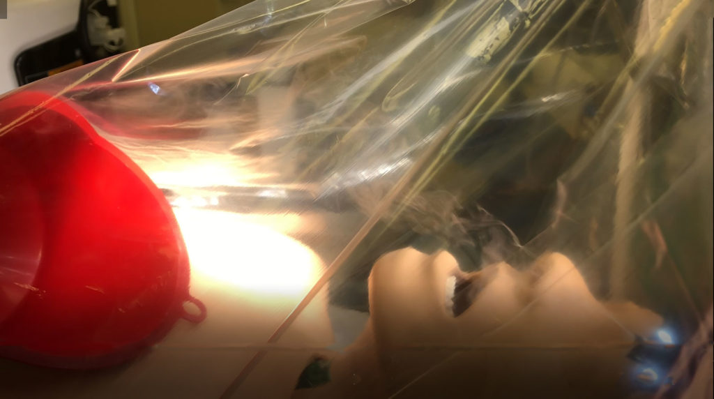 Figure 2. Depicts generated smoke being evacuated by the surgical smoke evacuator, under the plastic drape tent on a <a href="https://www.youtube.com/watch?v=n-5EXorJimg" target="_blank" rel="noopener">video clip</a> captured by the authors.