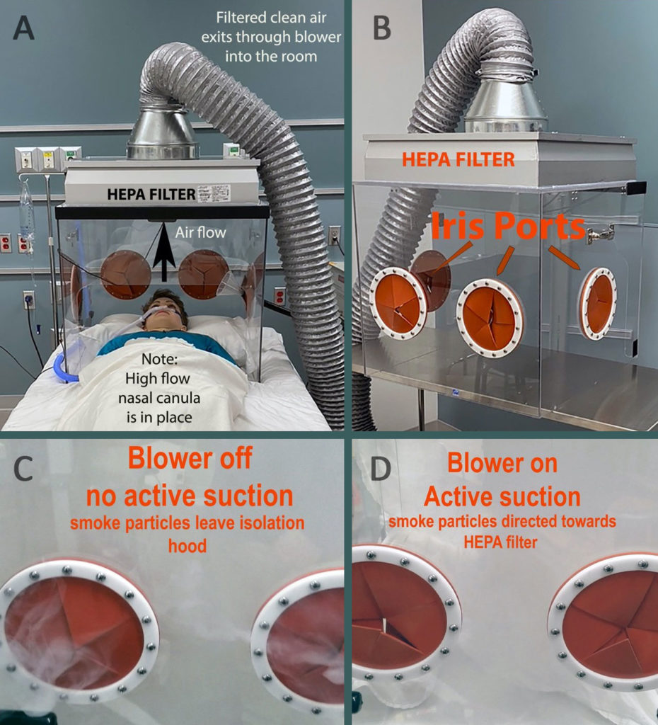 Figure 1. The Aerosol Hood demonstrating use of a high-flow nasal cannula (A). Rear-view (caudal) image of the Aerosol Hood, showing all iris ports and the HEPA filter (B). Images 30–40 seconds after igniting a smoke candle within the hood; left: no active suction (C); right: active suction at >10,000 L min-1 (D). The active suction directs smoke particles towards the HEPA filter and releases clean air into the room.<br /> <b>Published with author permission.</b>